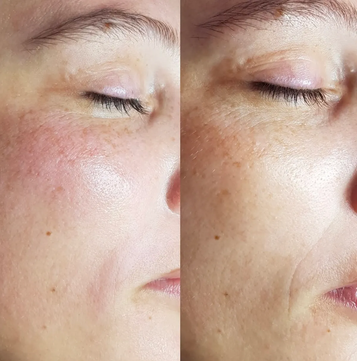 Happy Skin by Victoria 3