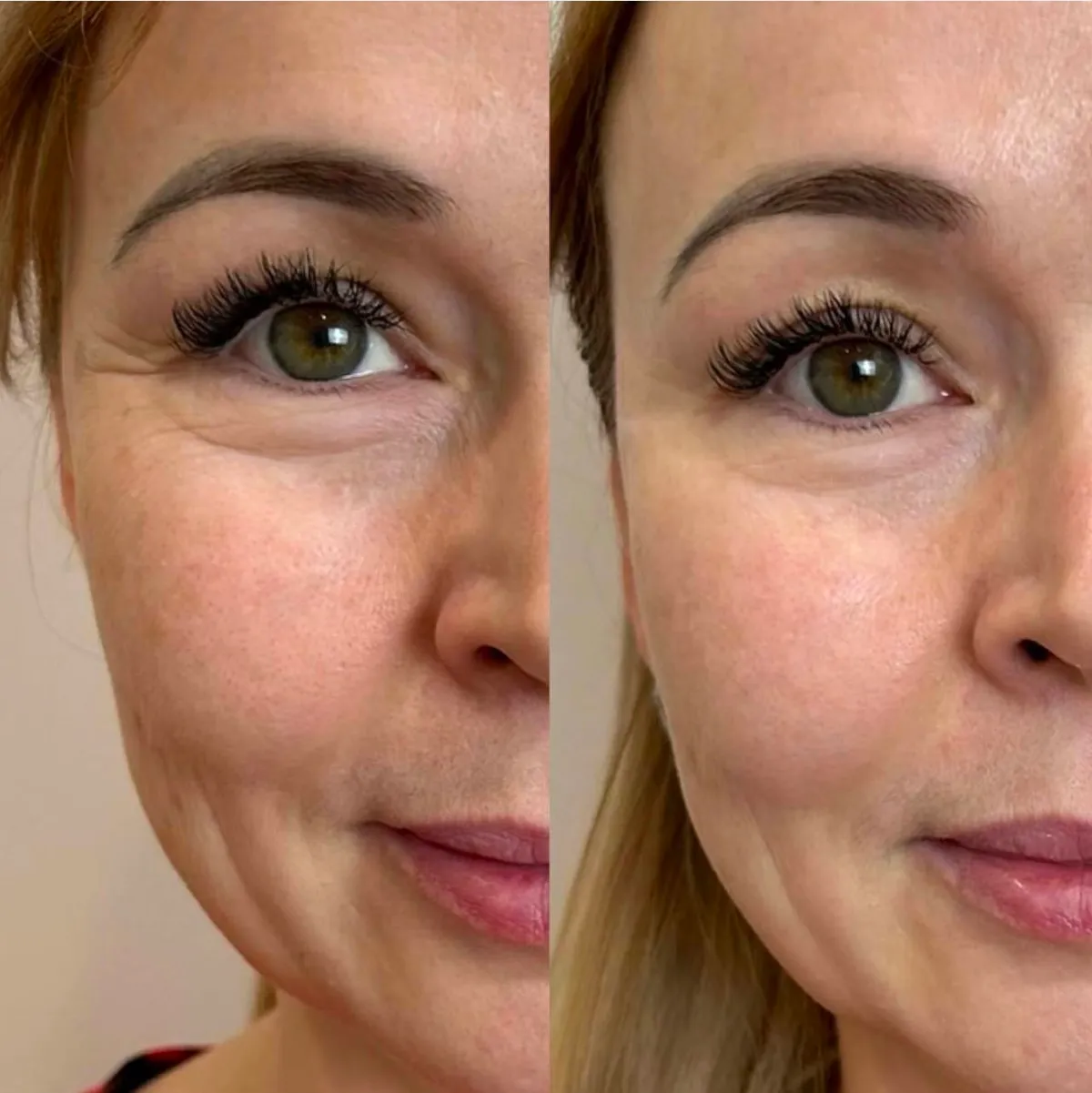 Happy Skin by Victoria 4